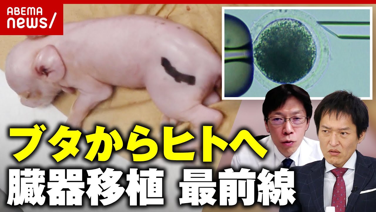 【ブタからヒトへ】「ドナー臓器として現実味を帯びてきた」そもそもなぜブタ?胎児間の腎臓移植の研究も…”異種移植”最前線|ABEMA的ニュースショー