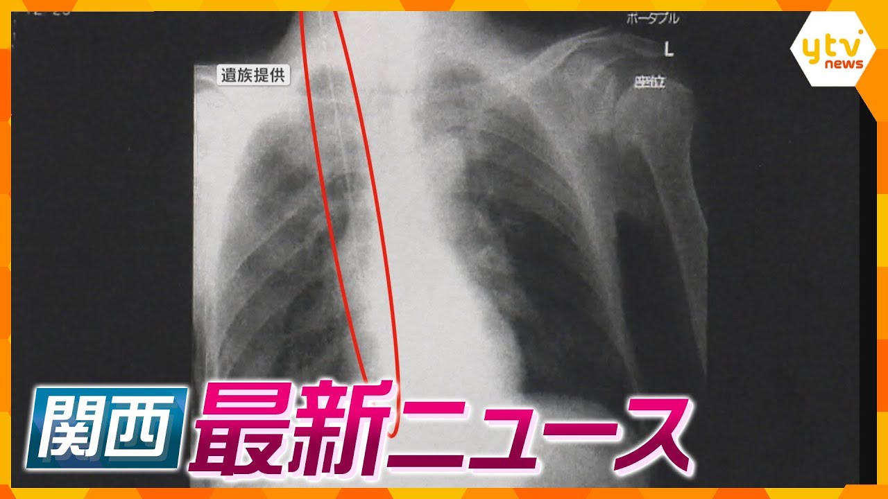 【ニュースライブ4/15(月)】体内にワイヤ放置 患者死亡 医師に有罪/先天性難病の胎児の手術 日本初成功/500株以上の大麻栽培か　 ほか【随時更新】