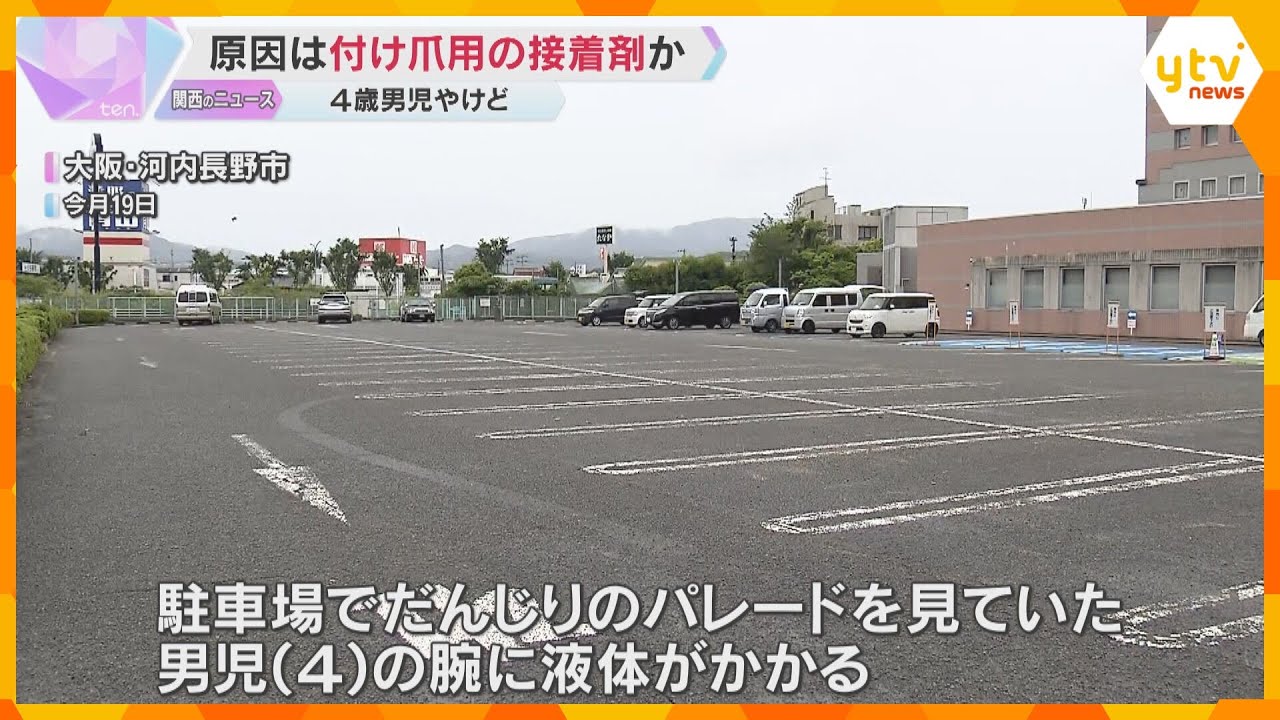 液体かかり4歳男児やけど　近くの人が使っていた付け爪用の接着剤が原因か　警察は事件性なしと判断