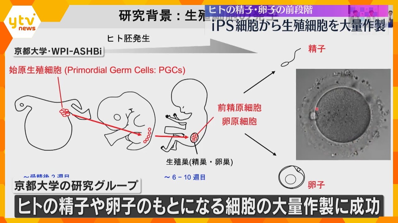 不妊症治療の研究に期待　iPS細胞からヒトの精子や卵子の基になる生殖細胞の大量作製に成功　京大