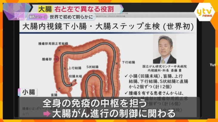 世界初！大腸が右側と左側で異なる役割があること明らかに　がんの新治療法の開発に期待　大阪大学など