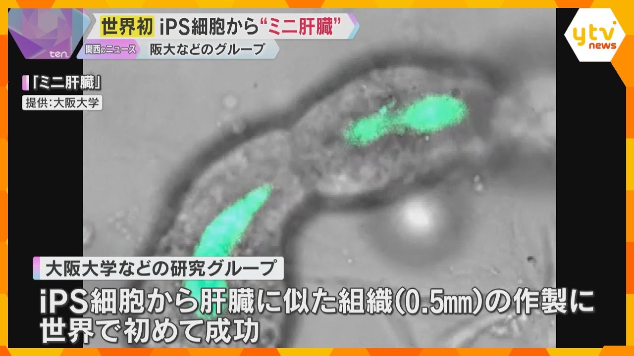 「生存が改善する治療できる」iPS細胞から世界初の「ミニ肝臓」重度の肝不全の症状改善　臨床研究へ