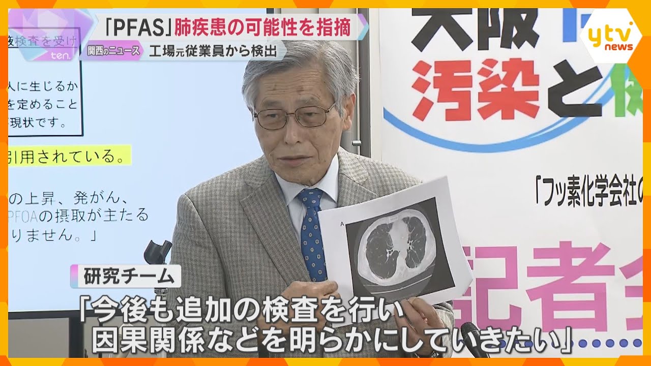 「PFAS」で肺疾患の可能性を指摘　工場の元従業員から代表物質が検出　間質性肺疾患の特徴も