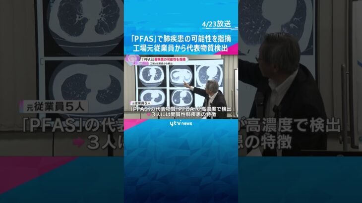 「PFAS」で肺疾患の可能性を指摘　工場の元従業員から代表物質が検出　間質性肺疾患の特徴も　#shorts #読売テレビニュース