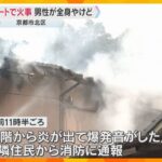 「すごい火柱」京都市でアパート火災　住人とみられる60代男性が全身やけどで搬送　約80㎡焼損