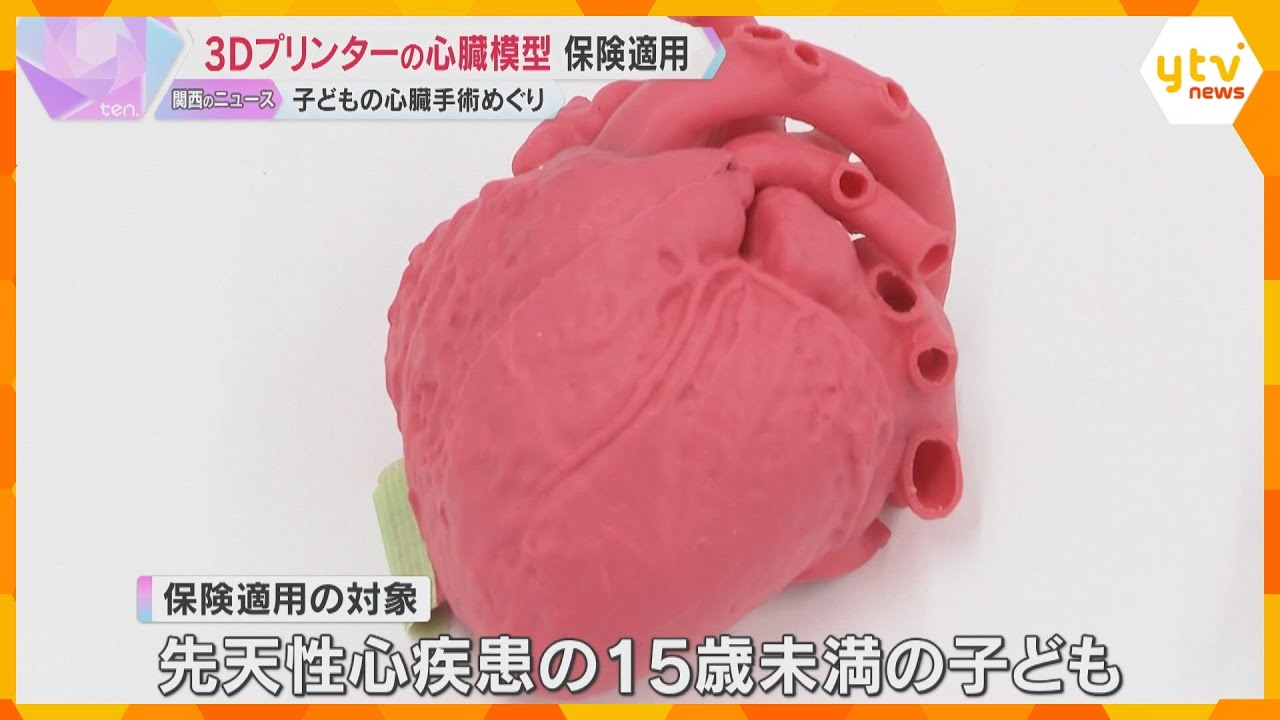 難しい子どもの心臓手術に光　3Dプリンターで作った実物大の模型に保険適用「海外でも使えるように」