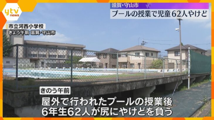 小学校のプールの授業で児童62人やけど　プールサイドのマットに座っていた間か　気温は35.9℃　滋賀・守山市