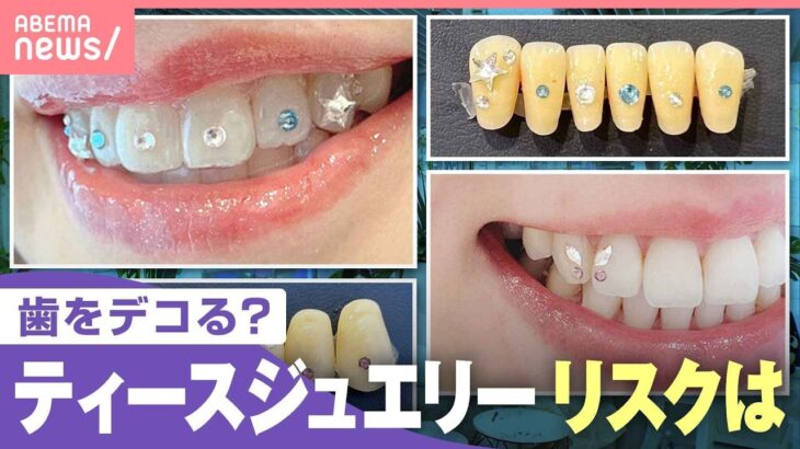 【デコる】歯の表面にストーン“ティースジュエリー”静かなブームも…リスクは？「装着後の適切なケアを」｜わたしとニュース
