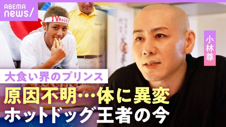 【小林尊】「90秒で12Lの水を飲む」大食いで過酷トレーニング…代償は”原因不明の体の異変” 番組出演時代の収入は｜NO MAKE