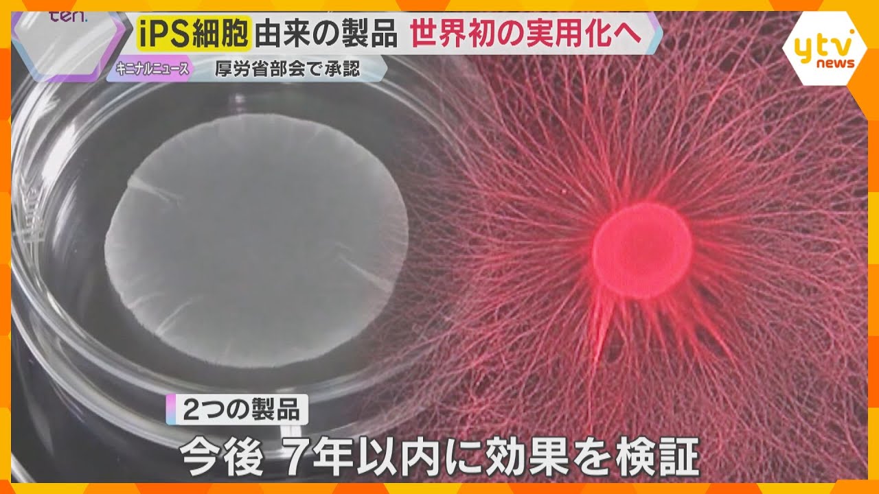 iPS細胞による再生医療が世界初の実用化へ　心臓病とパーキンソン病の治療に踏み出す大きな一歩
