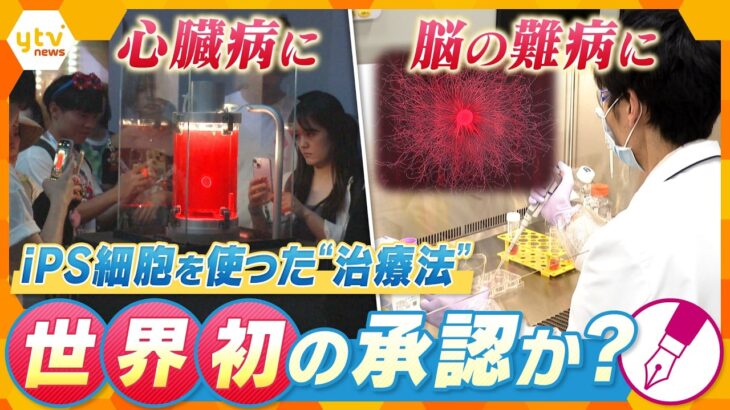 【キシャ解説】世界初の承認か！iPS細胞による“治療法” 脳や心臓の病気に効果【かんさい情報ネットten.】