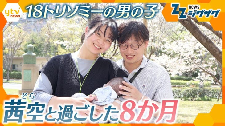 面会は1日1時間、撮った写真は9000枚以上…18トリソミーの息子と過ごした8か月【ニュース ジグザグ】