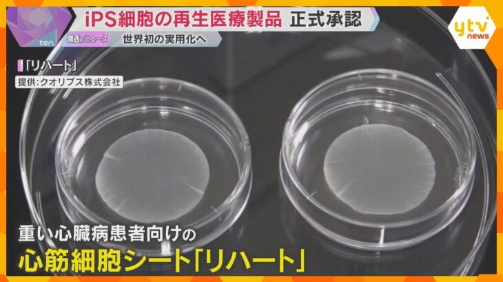 iPS再生医療製品が世界初承認　心臓病とパーキンソン病の新治療が早ければ今年夏にも保険適用へ