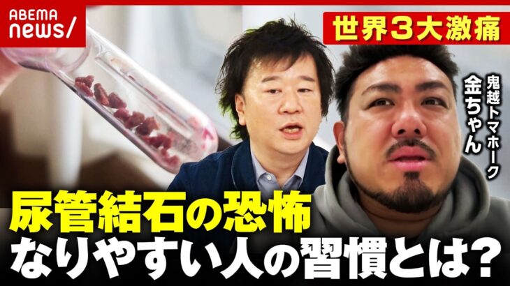 【尿管結石】「尿道にピキッと」鬼越トマホーク・金ちゃん悶絶の激痛「ブラックコーヒーを…」なりやすい人は？医師解説｜ABEMA的ニュースショー
