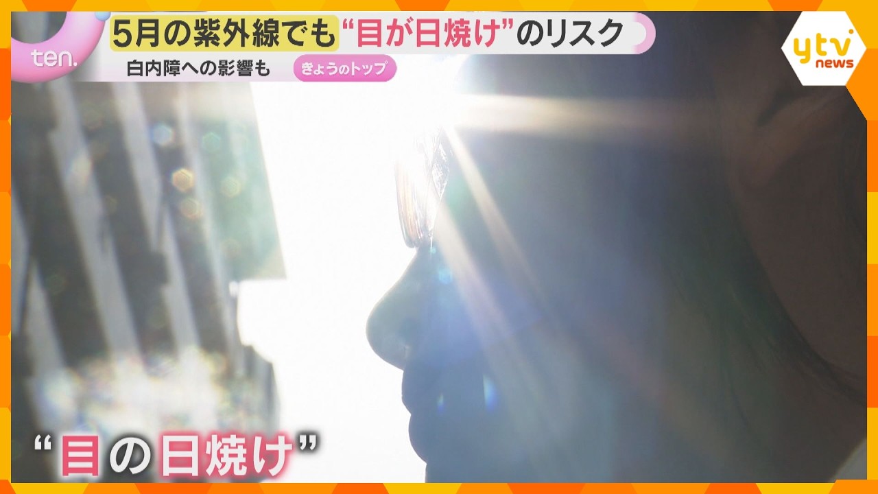 “目の日焼け”対策していますか？5月の紫外線でもリスク　白内障への影響は？サングラス導入の高校も
