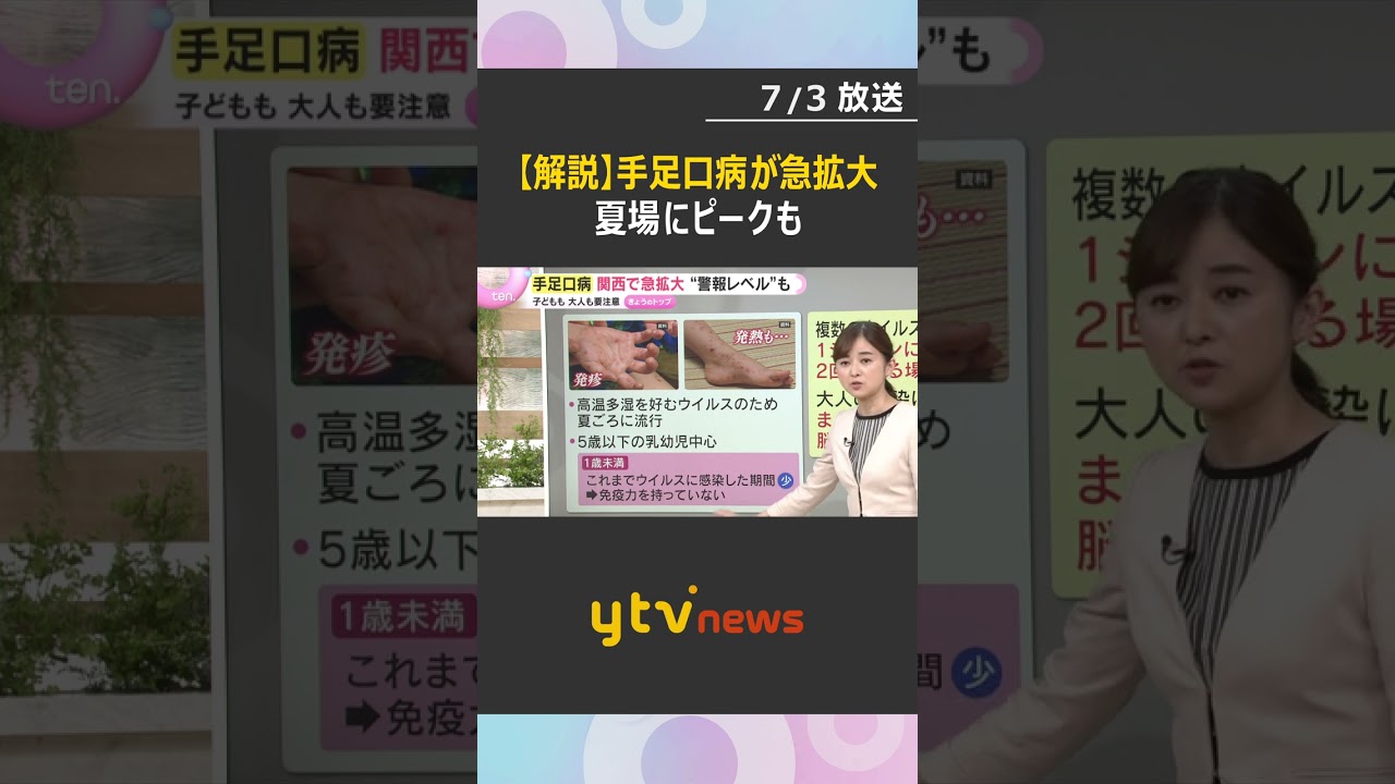 【解説】急拡大する手足口病 乳幼児中心に感染増加で夏場に警戒 大人は重症化恐れ…感染対策の徹底を#shorts #読売テレビニュース