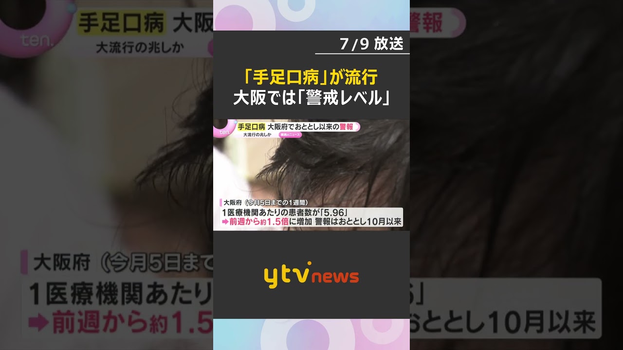 大流行の兆しか 手足口病が大阪府で警報レベルに 患者の約半数が1歳児#shorts #読売テレビニュース